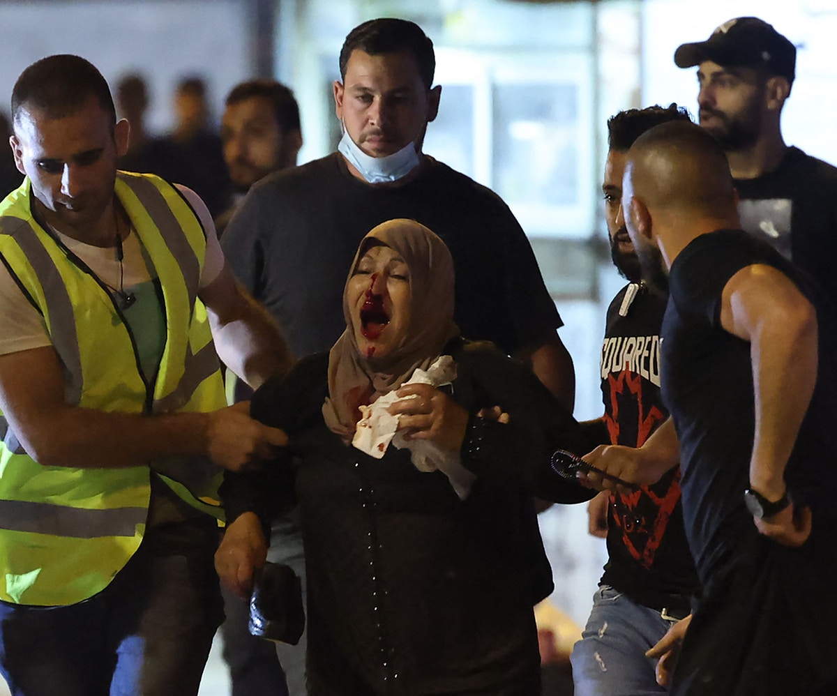 80 مصابا فلسطينيا بمواجهات مع قوات الاحتلال في القدس