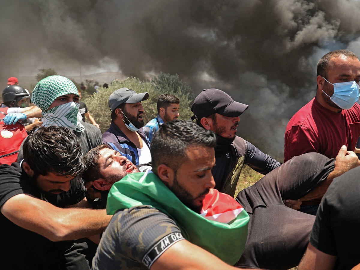 إصابة فلسطينيين بمواجهات مع القوات الإسرائيلية في نابلس