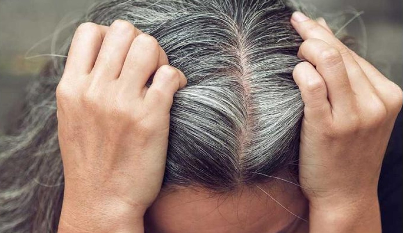 دراسة: الاجهاد يمكن ان يسرع عملية ظهور “الشيب”