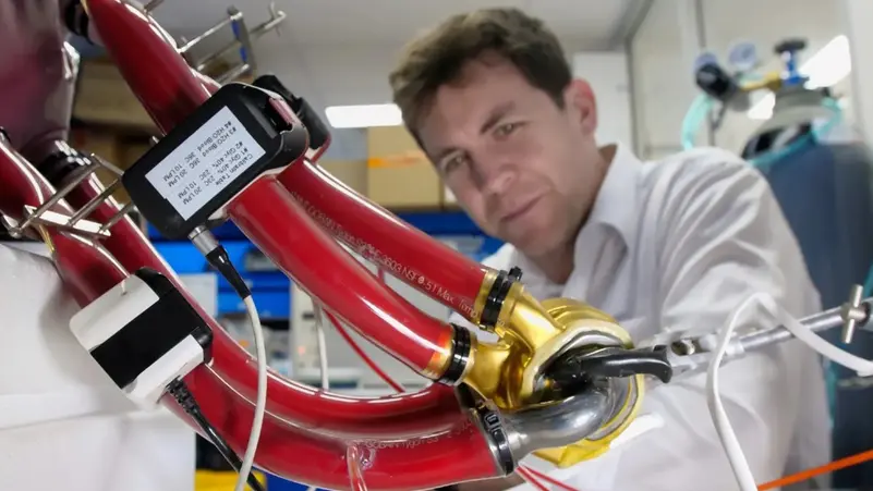 لأول مرة.. قلب من التيتانيوم بصدر مريض حي