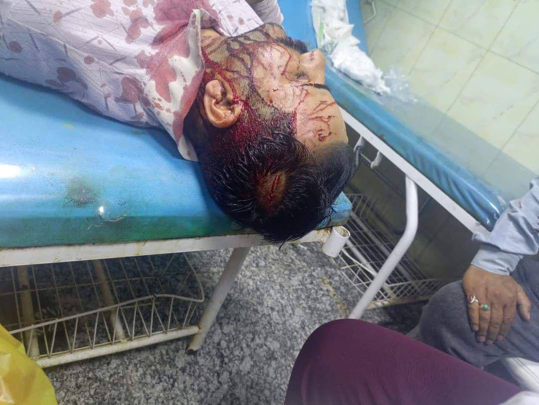 مواطن يعتدي بالضرب المبرح على أحد منتسبي مركز صيانة كهرباء الشعلة في مدينة الناصرية