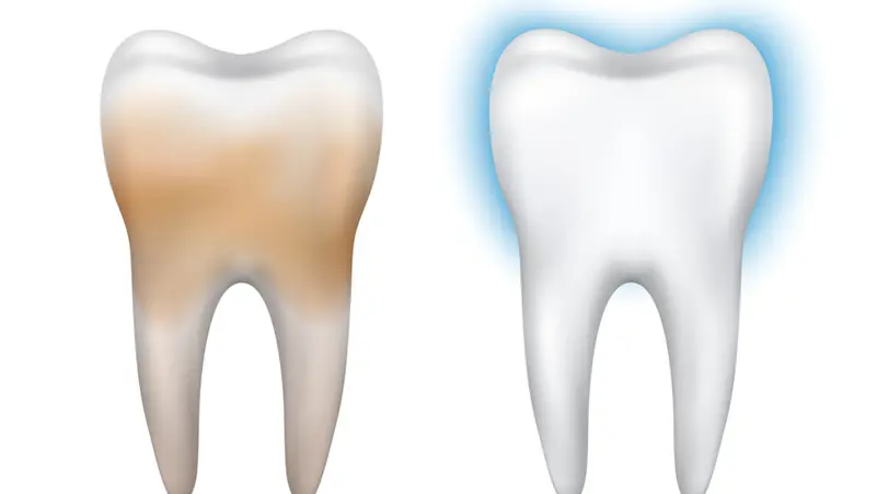 علاجات منزلية لإزالة البقع الصفراء من الأسنان