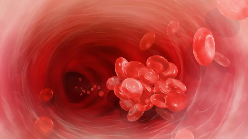 التزم مكتبك لتفادي جلطات الدم.. تحذير للموظفين من الوقوف لفترات طويلة