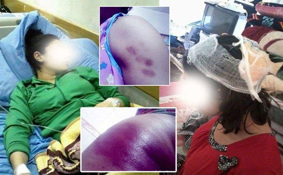 مرصد حقوقي يوثق عملية بيع واغتصاب شابة ايزيدية في بغداد