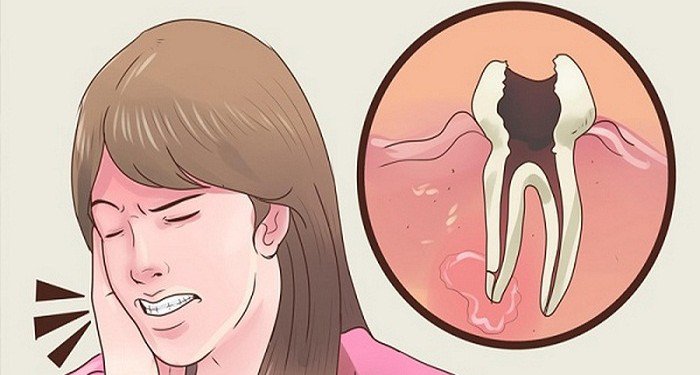 نصائح لتخفيف الام الضرس