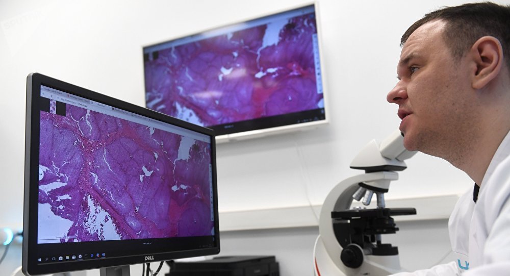 علماء روس يبتكرون نظاما يكشف عن مرض السرطان خلال 20 ثانية