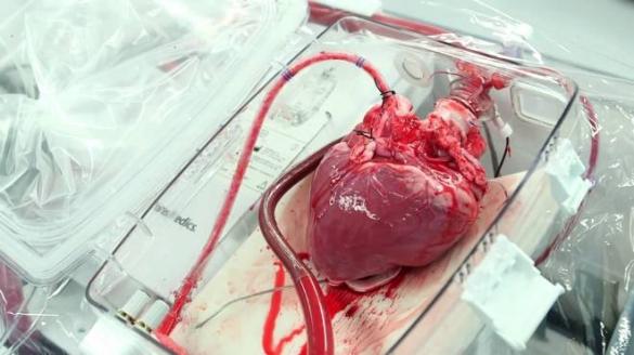 علماء يطورون أول قلب بشري نابض من الخلايا الجذعية