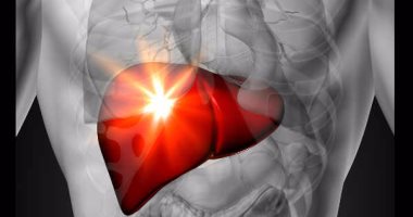 اعراض تليف الكبد اهمها فقدان الوزن غير المبرر